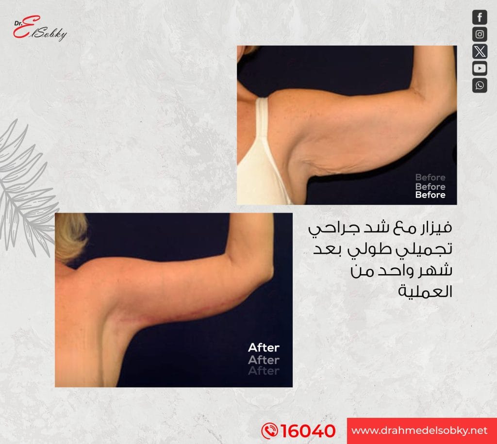 Before-and-after-2-copy (1)