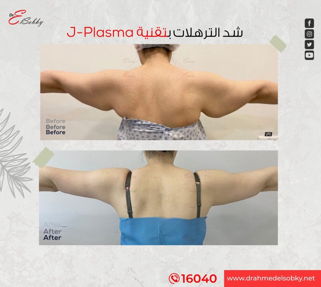 Before-and-after-2aaq (1)