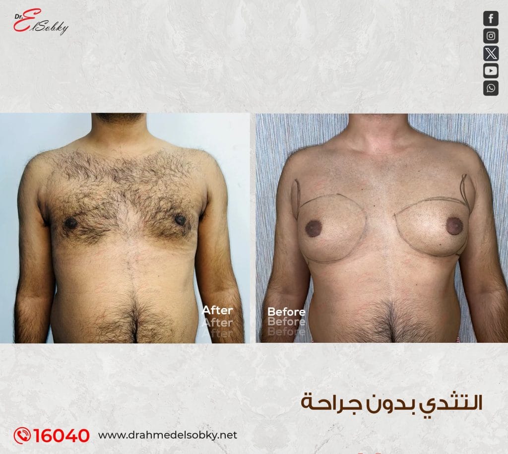 Before-and-after-5aa copy (1)